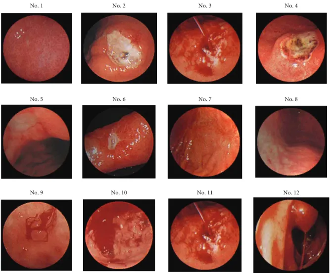 Figure 13: Demosaicked GI images.