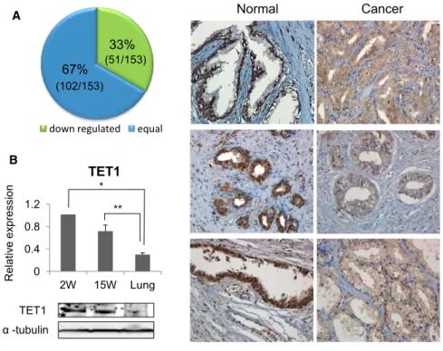 Figure 1. TET1 Is Decreased in Human Prostate Cancer Tissues and Implanted Prostate Cancer Cells Metastasized from Mouse Prostate to Lung