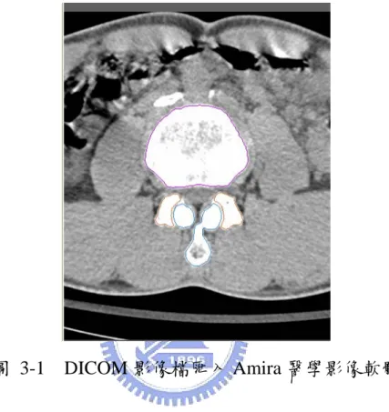 圖 3-1  DICOM 影像檔匯入 Amira 醫學影像軟體 