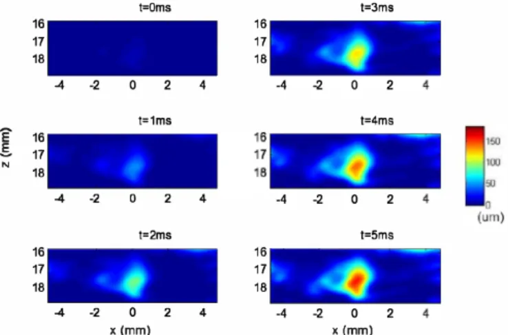 Figure  3  shows  the  time  sequence  of  ultrafast  plane  wave  pMMUS imaging.  The  magnetic pulser was delayed  850  f..lS  after  the  Prodigy  trigger  signal