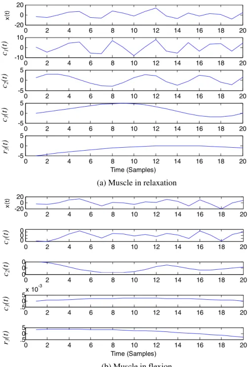 Fig. 3 A typical example of an empirical EMG signal and corresponding empirical mode