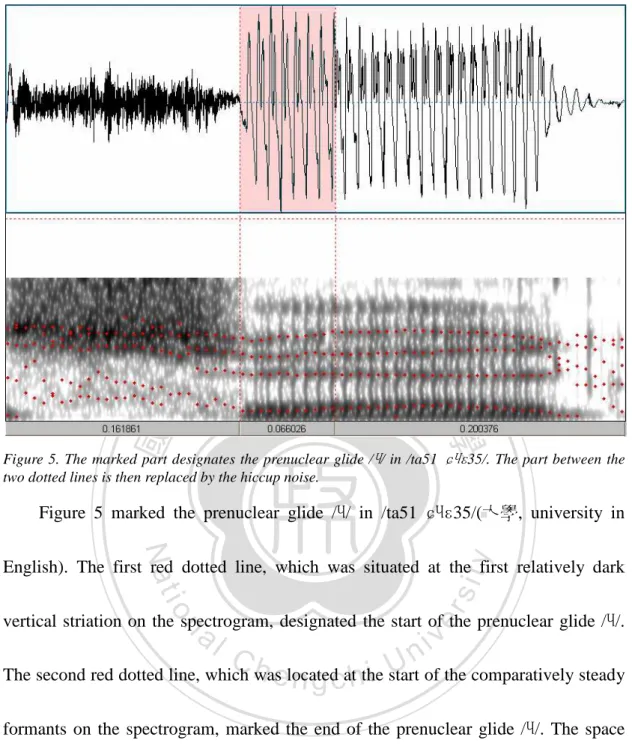 Figure 5. The marked part designates the prenuclear glide / / in /ta51  35/. The part between the  two dotted lines is then replaced by the hiccup noise