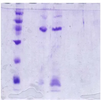 Figure 3.    The SDS-PAGE analysis of human α-L-fucosidase with the estimated MW  of 50 kDa   