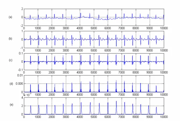 Fig 3.7 Flow chart of R wave detection algorithm (a) Original signal (b) Output of  band-pass filter (c) Output of differentiator (d) Output after squaring (e)  Result after moving window-integration 