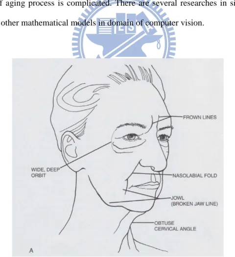 Figure 2. 1 The aging effect of midface [ZKT01] 