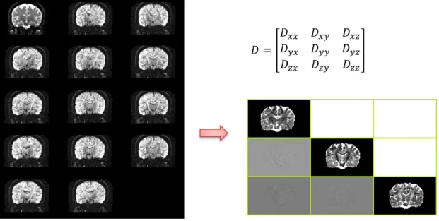 Figure 1.1: One slice of Diffusion tensor image (right) generated by diffusion-weighted images (left)