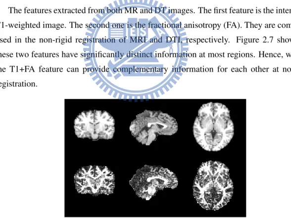 Figure 2.7: This figure displays three different views of MRI (top row) and FA (bottom row) brain image