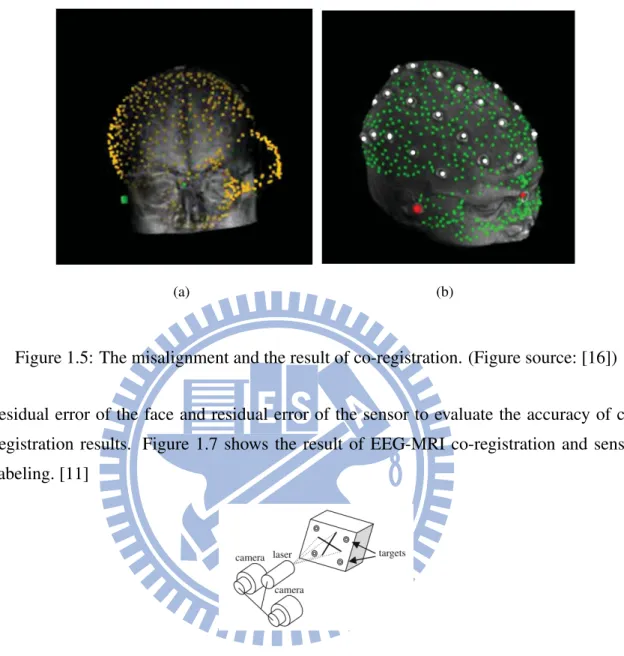 Figure 1.5: The misalignment and the result of co-registration. (Figure source: [16])
