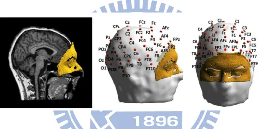 Figure 1.7: The result of EEG-MRI co-registration and sensor labeling. The MRI and headmodel co-registered with the scanned face and the positions of sensor