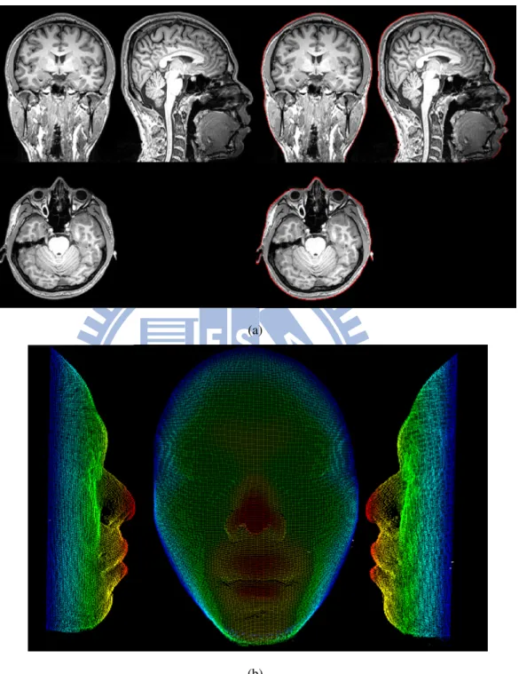 Figure 2.3: The result of segmentation of Scalp points from MRI. (a) The left shows the MR image, and right shows the segmentation of scalp points that superimposed on the MR image