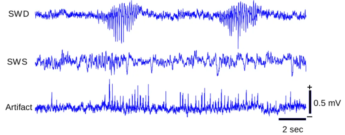 Fig. 2.1  EEG examples during the wakefulness (WK), spike-wave discharge (SWD),  slow-wave sleep (SWS), and movement artifact