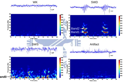 Fig. 4.7  Spectral analysis in four behavioral states. 
