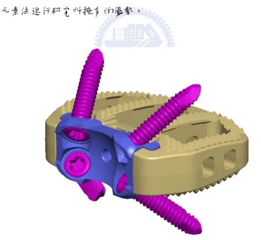 圖 1-7 SynFix-LR 融合器外型 