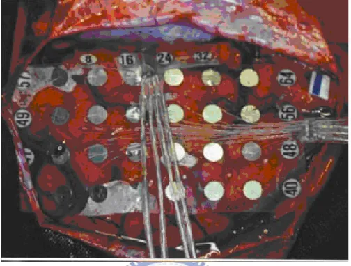 Fig. 2.3. The electrode array which is used for long-term EEG recording [18]. 