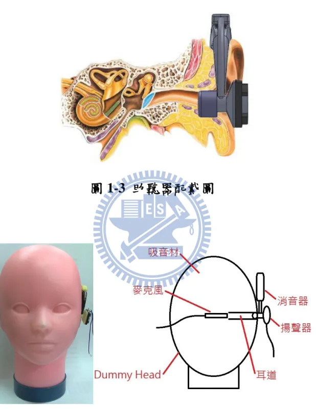 圖 1-3  助聽器配戴圖 