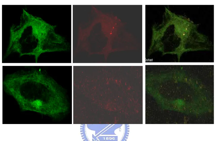 Fig. 10 Immunofluorescent Staining in HeLa cells. HeLa cells were transiently  transfected with EGFP-Mst3 WT  (A) or EGFP-Mst3 KR  (B)