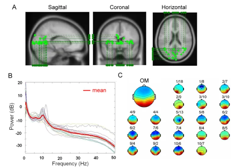 Fig. 3-1: Equivalent dipole source location, spectra, and the scalp maps of the occipital component  across 20 sessions from 10 subjects