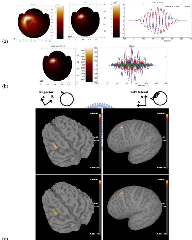 Figure 4.7: Simulation 1 - Cortical Source Distribution Using Unmixing Matrix Ap- Ap-proach