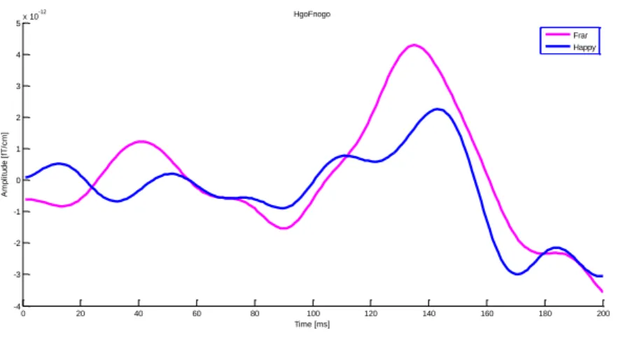 Figure 3.6: Waveforms of mean ERF regional amplitudes evoked by HgoFnogo condition.