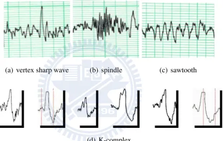 Figure 1.1: (a) vertex sharp wave; (b) spindle wave; (c) sawtooth wave; (d) K-complex wave