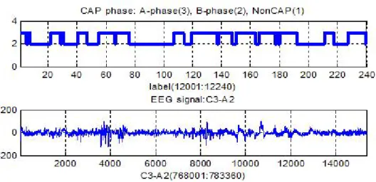 Figure 1.2: CAP sequence and EEG signal C3-A2