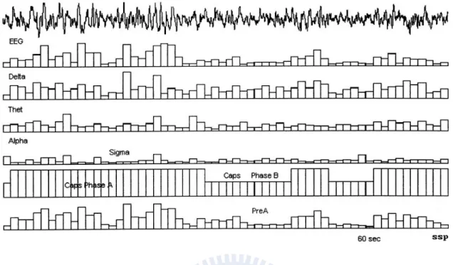 Figure 2.2: An CAP automatic classification result with the duration of 60 s. The top row id the EEG CA-A1 channel