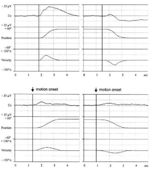 Figure 1-3: The ERP response to X axis rotation. Upper plot: The rotation ERP under 1-G  gravity; Lower plot: The rotation ERP under 0-G gravity 