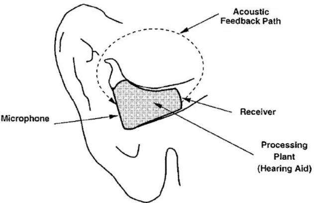Fig 2.  Acoustic feedback in a hearing aid inside of a human ear 