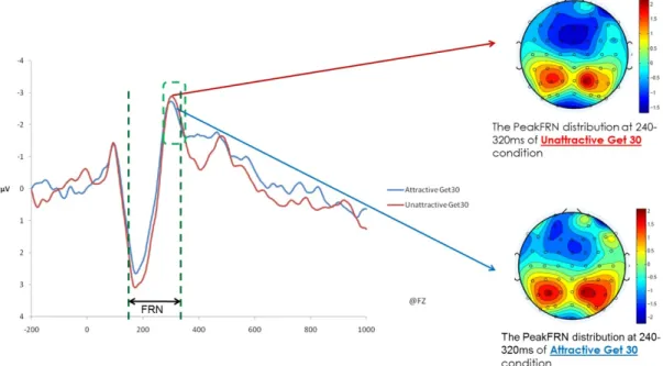 Figure 4. The FRN amplitude difference of Attractiveness at FZ, offer get 30 and scalpel distribution   
