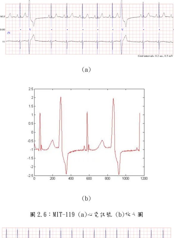 圖 2.6：MIT-119 (a)心電訊號 (b)放大圖 