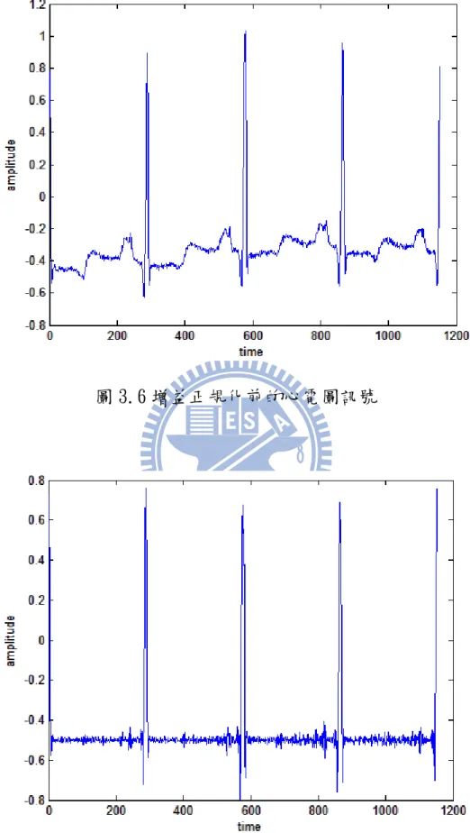圖 3.6 增益正規化前的心電圖訊號 