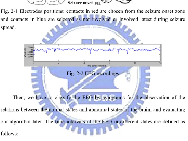 Fig. 2-2 EEG recordings 