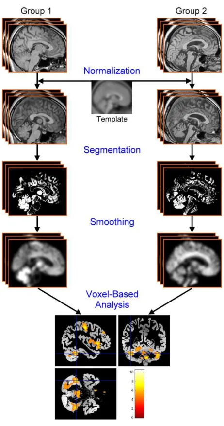 Figure 2.3: Flowchart of basic VBM steps.