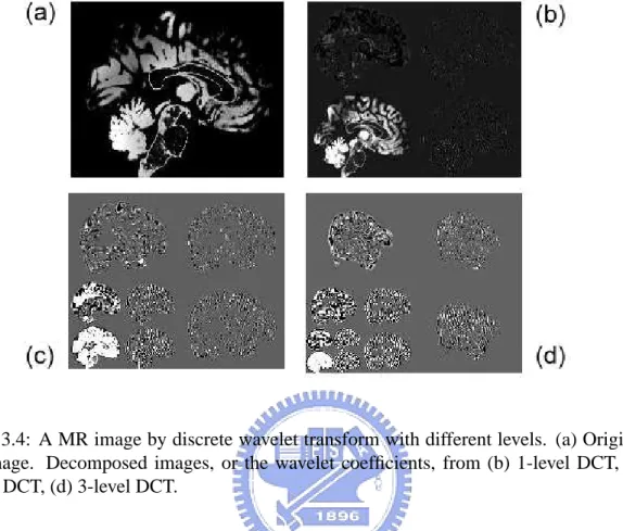 Figure 3.4: A MR image by discrete wavelet transform with different levels. (a) Original MR image