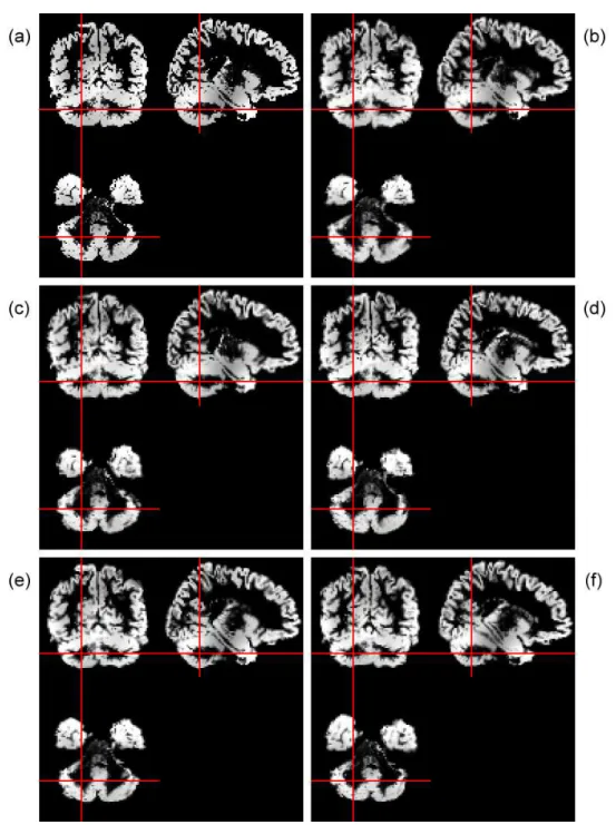 Figure 4.2: The source and simulated images by TPS shown in the coronal, sagittal and axial views