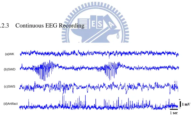 Fig. 2.3  All kinds of EEG patterns in a continuous recording of a Long-Evans rats 