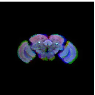 Figure 5 Two fly brains are warped into target fly brain (three fly brain ware warped  together)