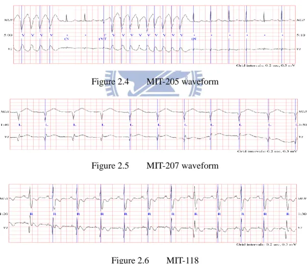 Figure 2.4  MIT-205 waveform 