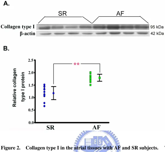 Figure 2. Collagen type I in the atrial tissues with AF and SR subjects. The cellular proteins were extracted from the tissues and applies onto 8% SDS-PAGE as 40 μg per lane