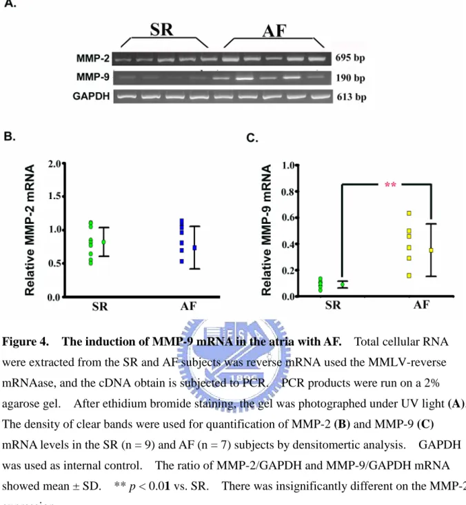 Figure 4. The induction of MMP-9 mRNA in the atria with AF. Total cellular RNA were extracted from the SR and AF subjects was reverse mRNA used the MMLV-reverse mRNAase, and the cDNA obtain is subjected to PCR
