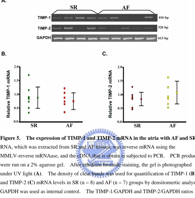 Figure 5. The expression of TIMP-1 and TIMP-2 mRNA in the atria with AF and SR. RNA, which was extracted from SR and AF tissues, was reverse mRNA using the