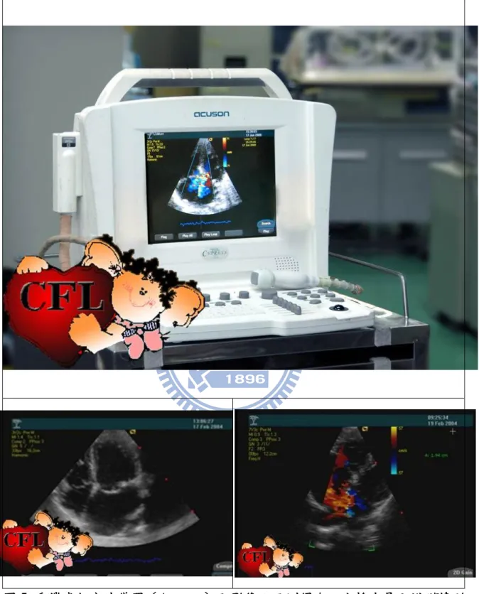 圖 5  手攜式超音波儀器（Acuson）及影像：可測得左心室輸出量及瓣膜情形 