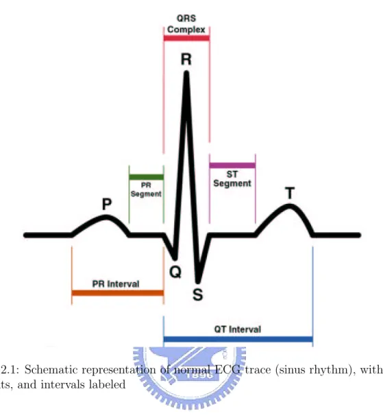 Figure 2.1: Schematic representation of normal ECG trace (sinus rhythm), with waves, segments, and intervals labeled