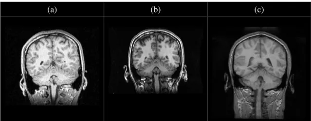 Figure 3.2: T1-weighted MR images acquired from different scanners present quite differ- differ-ent intensity properties