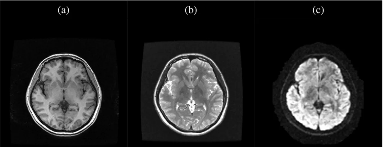 Figure 3.4: MR images acquired using different pulse sequences. The intensity charac- charac-teristics of tissues vary between different modalities