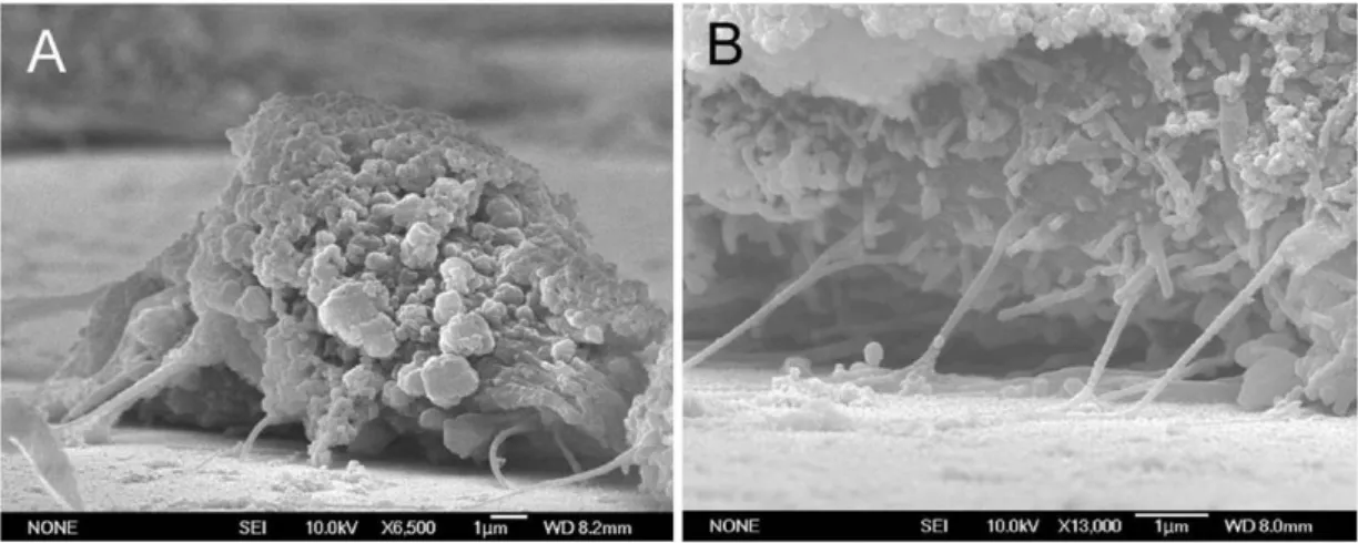 Figure  6  SEM side-view  images  showing  the poor  cell attachment  of  NIH-3T3 cells  grown on the 100 nm nanodot array
