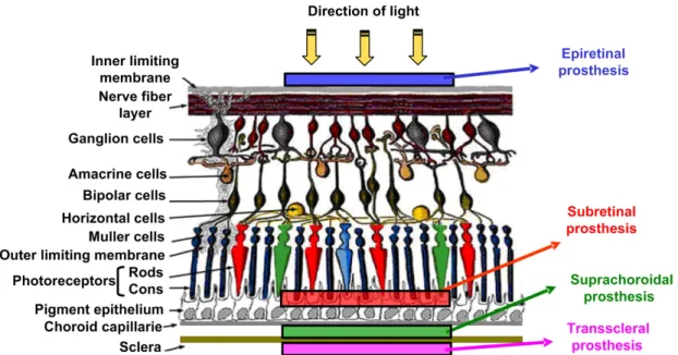 Figure 1.1 Cross-section of retina and implementation system of artificial retina  prostheses
