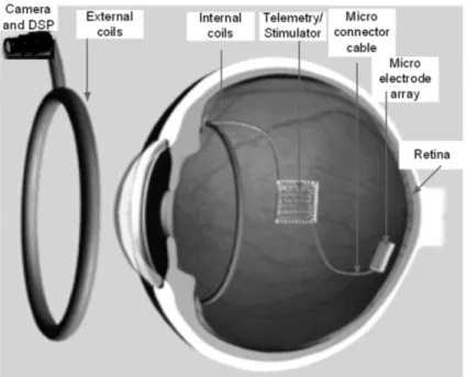 Figure 1.2 the visual prostheses are used to restore eyesight to the blind. 