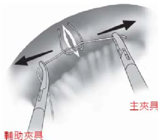 圖 7 縫線兩端拉緊 [1] 合的部位，至此第一個結完成。這一連串打結的動作看似簡單，其 實不然。因人體腹腔內空間狹小，要操作主夾具與輔助夾具做縫線 纏繞與拉緊的動作時，兩根夾具很容易互相碰撞，操作不易。而且 縫線的材質為尼龍線，纏繞的過程縫線時常從輔助夾具上滑落，並 不容易固定於輔助夾具上，更增加了操作的困難。而視縫線尺寸的 不同，醫師需要重複打結的次數也不相同，多次打結的動作也是拖 延整體手術時間的主因之ㄧ。Dulucq [2]  與 Bruce [3] 及 Conor [4] 等人 也提到體內打結須反