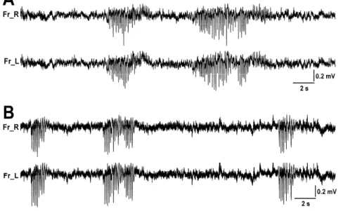 Figure 9A show a barrage of representative SWDs of Long-Evans rats. The SWDs were  bilateral synchronization